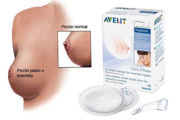 Pezones planos o invertidos, una de las principales causas de deserción en la lactancia materna